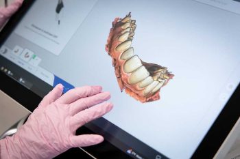 Millcreek Family Dental team member show the 3D image of a patients teeth that will be used to create a guard